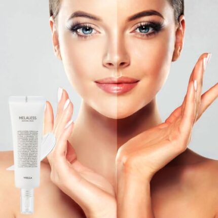 ＶＥＬＬＡ VELLA Melasma Treatment Melaless White Cream Tranexamic Acid Dark Spot Freckle Reducer Brightening Skin Tone Korean Skin Care